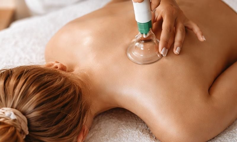 Therapist performing cupping therapy