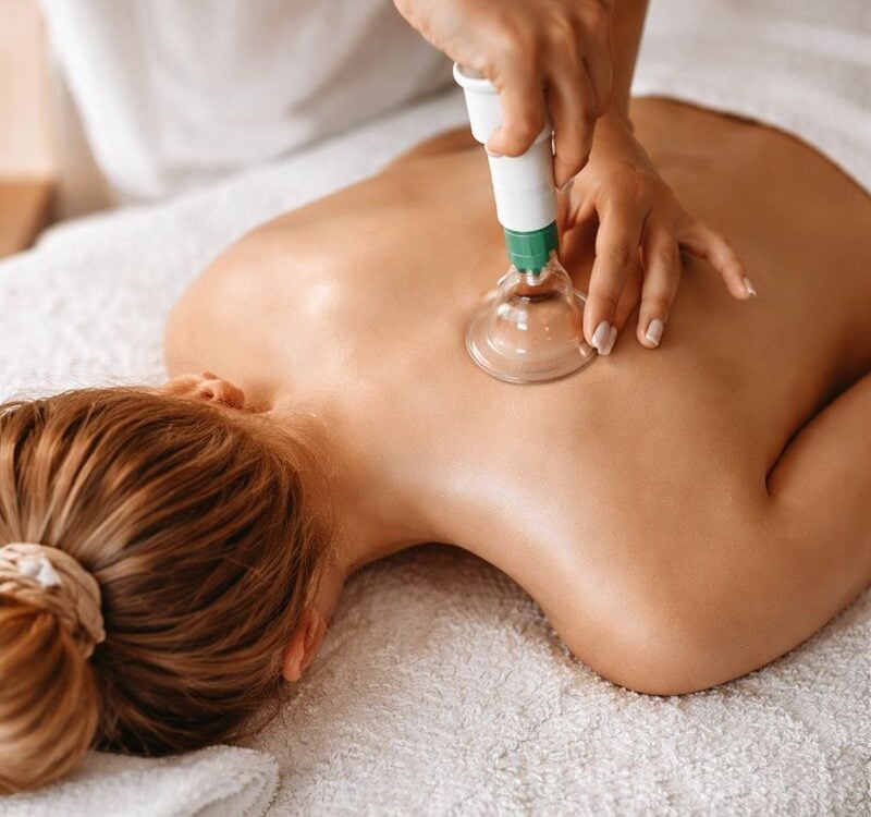 Therapist performing cupping therapy